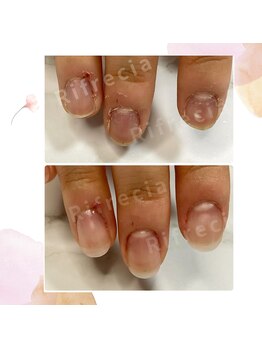 リフレシア(Rifrecia)/爪周りも丁寧なケア