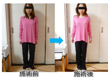 銀座スッキリ整体サロン/姿勢矯正で立ち姿も美しく！