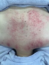 クラティス 塩尻店(CRATIS)/血行促進代謝アップで潤い蘇る