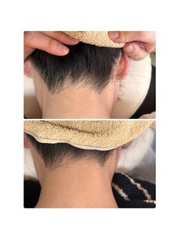 ティアレ 廿日市店(Tiare)/うなじ脱毛