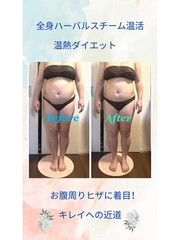 ヨサパーク ジュエル ハビビ 水木店(YOSA PARK JEWEL HABIBI)/お客様の施術後ボディ変化お写真