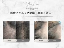 ユウキュウ(you q.-)