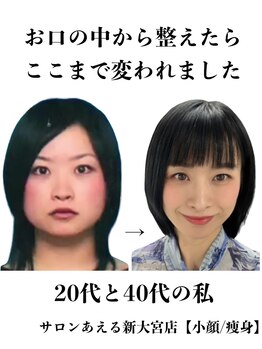サロンあえる 新大宮店/ナチュラルに小顔が叶う