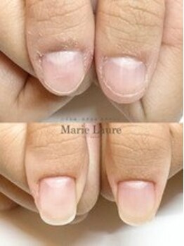 マリーロール 梅田店(Marie Laure)/自爪育成/深爪矯正/ネイルケア