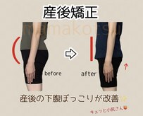 ママコツ矯正