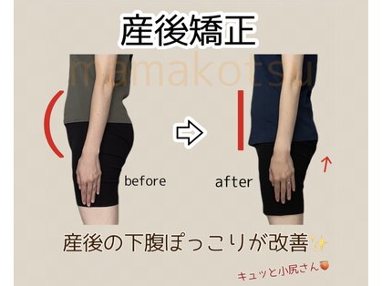 ママコツ矯正の写真