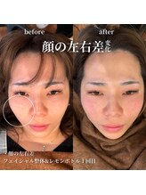 フェアリーフェイス 南森町店(Fairy Face)/南森町/小顔矯正&レモンボトル