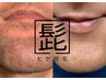 【MEN’S】【初回限定】【メンズ脱毛】顔全体鬚脱毛♪6,600→3,300円