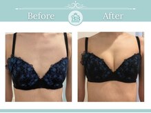 美人バスト 掛川店/【バストアップ/育乳静岡/掛川】