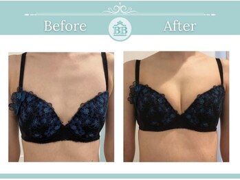 美人バスト 掛川店/【バストアップ/育乳静岡/掛川】