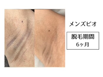 メンズビオ 神戸三宮店/