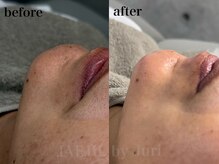 ジェジル バイ ジュリ(JAEJIL by Juri)/ポイントWAX Mパーツ/ 顎WAX