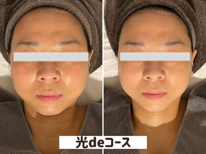 プライベートエステティックサロン クール(Coeur)の写真