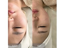 サロン ド ビビ(salon de bibi*)の雰囲気（顎下/頬/口横/横顔 多数改善!症例写真はフォトギャラリーへ。）