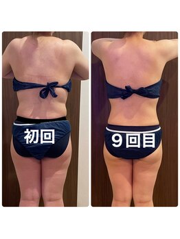 あきくに整骨院 美容整体院/スタートしてから２か月