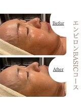 ソワ 恵比寿(soi)/エンビロンBASICコース