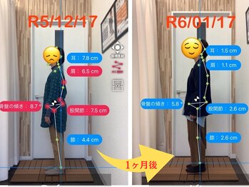 ナオル整体 札幌院(NAORU整体)/札幌円山/整体/姿勢矯正/猫背