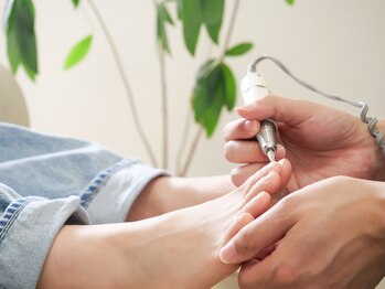 北区天神橋巻き爪センター/《巻き爪矯正》