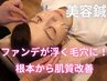 ファンデが浮く毛穴に！根本から肌質改善(美容鍼)