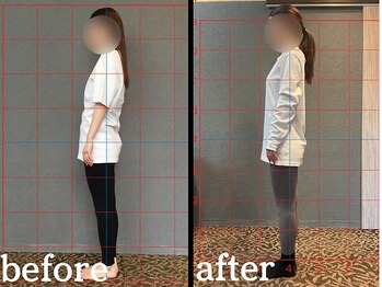 ヴレ 福岡店(Vraie)/ぽっこりお腹、姿勢のせいかも