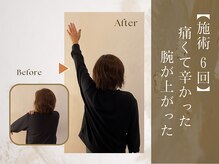 アロナプラス(Arona+)/施術1回