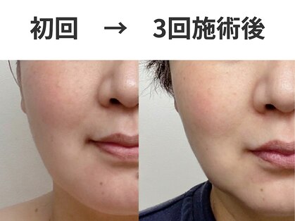 シーズボーテ(C's Beaute)の写真