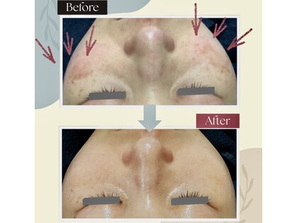 フルーヴ ルフレ(Fleuve Reflet)の写真