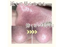 エミング(yeming)の雰囲気(毛穴エクストラクションで長年の毛穴お悩み/つまり/黒ずみ解決!)