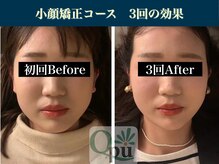 キュープ 表参道店(Qpu)/続けた方しか感じられない変化♪