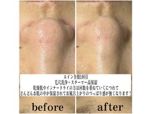 ジョルフ サロン オリジナル(JOLF salon original)の雰囲気（毛穴洗浄＋スチーマー高保湿☆冬の乾燥やインナードライの方にも）