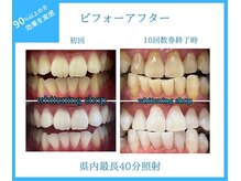ホワイトニングショップ 鳥取店
