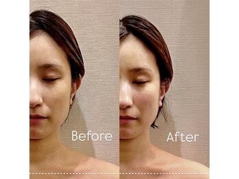 サロン ド プレシャス(Salon de Precious)/整体リンパマッサージ/肩こり◎