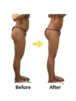 ムーロ(muro.)/Before After