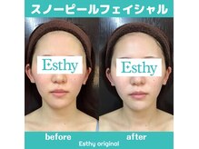 エスティ 浦和店の雰囲気(【支持率NO1フェイシャルオーダ豪華90分】※クーポン配信中)