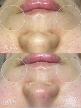 サロンドシェフィア(Salon de Chefia)/30代前半女性 症例写真