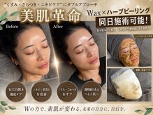 エヌワクシング バイナツ(N-Waxing bynatsu)