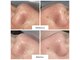 サロン ション(salon Shon)の写真