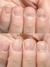 マリーロール 梅田店(Marie Laure)/自爪育成/深爪矯正/ネイルケア