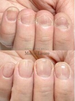 マリーロール 梅田店(Marie Laure)/自爪育成/深爪矯正/ネイルケア