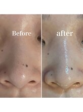 ペイジ(peige)/【peige】症例写真