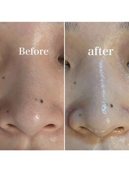 ペイジ(peige)/【peige】症例写真