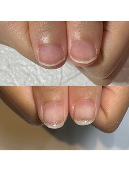 キュア(Cure.)/自爪育成ジェルネイルで美爪