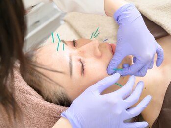 ドットニホカ(.NIHOKA)の写真/鍼灸サロンだからこそできる!毛穴/シミ/しわの改善に「.NIHOKAの美鍼」がおすすめ◎お悩みを根本から改善♪