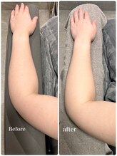 オーパーツ(OOPARTS)/ブライダルシェービング/笹塚