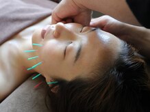 やなけん 亀戸店/たるみ/毛穴/小顔/美容鍼灸/痩身