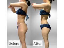 9割の方が初回から効果を実感！感動の口コミが後を絶ちません