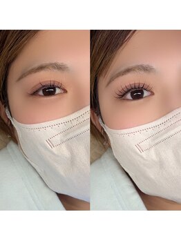 イチマルゴ ガーデン(105 GARDEN)/フラットラッシュ付け放題