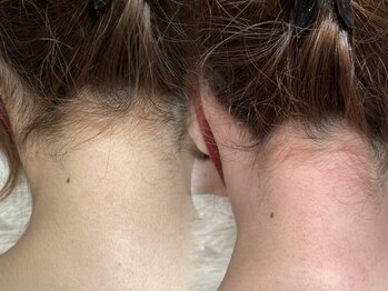 ミーククル(MEKUKURU)/うなじワックス