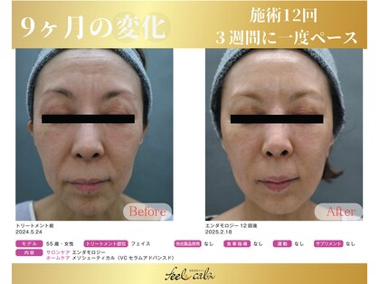 フィールカーム(feel calm)の写真