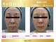 フィールカーム(feel calm)の写真